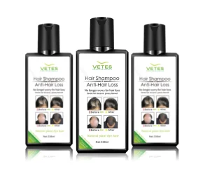 Natural Organic Shampoo for Anti-hair Loss Hair Growth Anti Hair Fall Shampoo