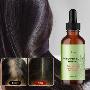 Natural Pure Rosemary Oil and Castor Oil Hair Growth Lotion Scalp Treatment Essential Oil for Anti Hair Loss and Hair Regrowth