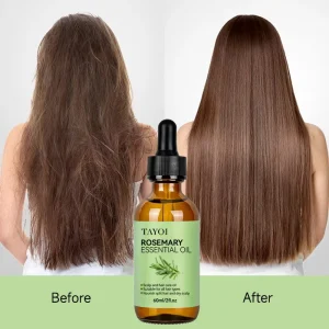 New Formula Hair Loss Care Herbal Growth Oil Scalp Circulation Improve Anti Dandruff Fizzy Smoothing Rosemary Essential Oil