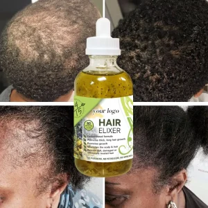 New Hair Growth Rosemary Essential Oil 100 Pure Hair Treatment Rosemary Oil Hair Growth Oil