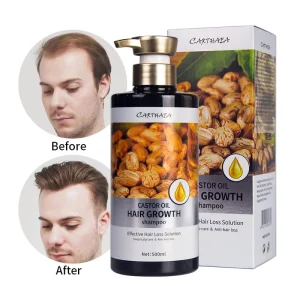 New Products Hair Growth Shampoo and Conditioner Private Label Natural Anti Hair Loss Shampoo Hair Growth Shampoo