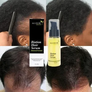 OEM Biotin Hair Growth Serum Hair Care Products Grow Fast Healthy Strong Hair Loss Treatment for Men and Women