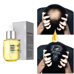 OEM Customized Hair Nutrient Solution Ginger Plant Based Hair Care Essential Oil Oil Control Volumizing Reduces Frizz