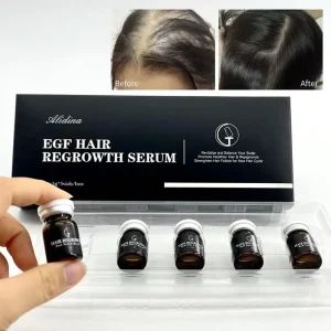OEM Fast Hair Regrowth Hair Loss Treatments Growth Restoration Natural Organic Herbal Anti Hair Loss Serum