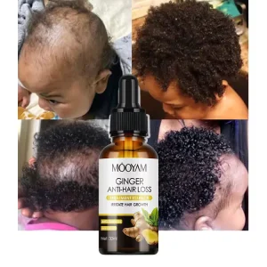 OEM Ginger Anti hair Loss Essence Nourishing Serum Powerful Hair Moisturizing Formula Smooth 30ml MOOYAM Hair Care Growth Serum