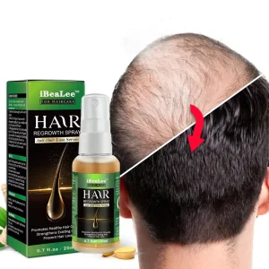 OEM Hair Growth Products Ginger Essence Fast Regrowth Serum Beard Growth Oil Hair Loss Care Beauty Scalp Treatment for Men Women
