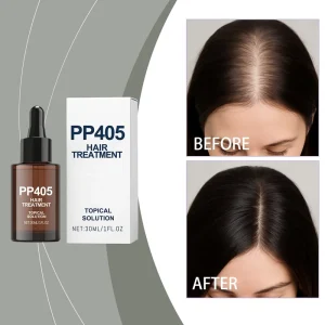 OEM Herbal Essential Oils for Hair Care Promotes Regrowth Anti Hair Loss Liquid Growth Serum Ginger Rosemary Vitamin E