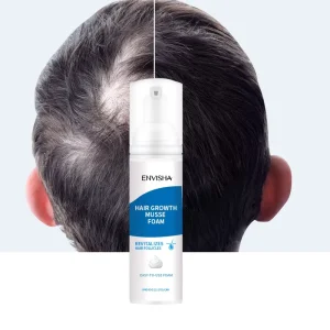 OEM New Anti Loss Fast Hair Care Growth Mousse Hair Growth Foam for Men Women Hair Regrowth Treatment