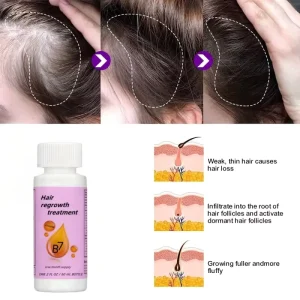 OEM ODM 2% Organic Herbal Tea Hair Growth & Repair Oil Concentrated Formula Prevents Hair Loss for Curly Dry & Damaged Hair