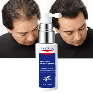 OEM ODM Hair Growth Serum Scalp Nourishing Strengthen Follicle Lightweight Leave-In Improve Men’s Hair Density Serum