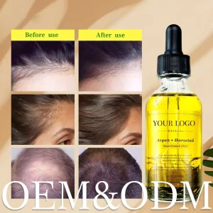 OEM ODM Herbal Hair Growing Hair Loss Serum Private Label Argan Oil & Hyaluronic Acid Hair Growth Serum Oil