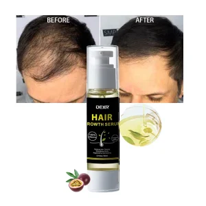 OEM ODM Private Label Moisturizing Hair Regrowth Treatments Improve Hair Loss Biotin Hair Growth Oil Serum
