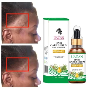 OEM Organic Anti Hair Loss Biotin Rosemary Oil Hair Growth Serum Repair Damaged Nourishing Hair Treatment Serum Oil