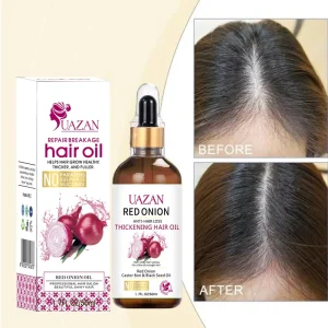 OEM Organic Natural Red Onion Hair Serum Nourishing Scalp Anti Hair Fall Repair Damage Promote Growth Hair Care Essential Oil