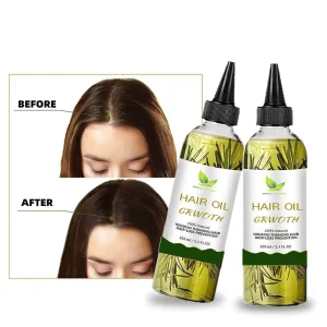 OEM Organic Natural Rosemary Mint Scalp Hair Growth Oil Hair Loss Serum Prevention Rosemary Mint Scalp Care Leaves Essential Oil