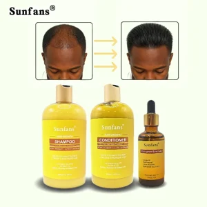 OEM Organic Tea Tree Rosemary Caffeine Anti Dandruff Moisturizing Hair Growth Shampoo