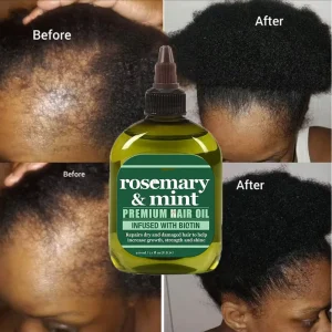 OEM Sulfate Free UV Protection Revives Nourishes Mint Hair Oil Natural Rosemary Oil for Hair Growth & Biotin