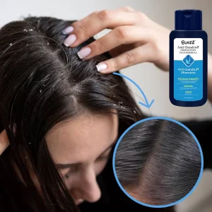 Oil Control Dandruff Shampoo Hair Regrowth Conditioners Moisturizes Improves Frizz Deeply Cleanses Scalp OEM Shampoo