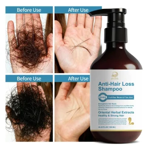 Organic 300Ml Anti Hair Loss Shampoo for Fortifies Weak and Fine Hair Improve Healthy Scalp and Strong Hair Roots