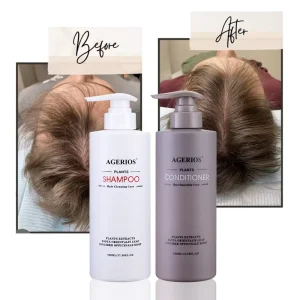 Organic Anti Dandruff Hair Growth Anti Hair Loss Shampoo Conditioner Cream for Curly Hair Sensitive Scalp 2 in 1 Formula