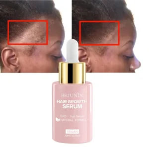 Organic Anti Loss Rosemary Human Regrowth Treatment Repair Oil Hair Growth Serum