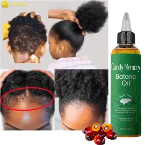 Organic Batana Oil for Hair Growth Nourishes Scalp Hair Batana Oil Gallon Women Men Hair Treatments Care