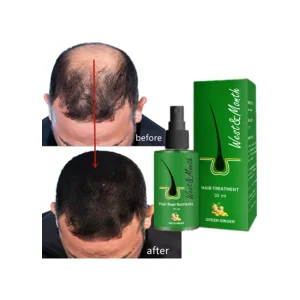 Organic Hair Care Herbal Regrowth Anti Hair Loss Gingseng Biotin Hair Growth Oil Green Ginger Hair Root Nutrients Spray