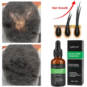 Organic Hair Growth Serum Encourages Scalp Oil Herbal Hair Growth Oil Essential Private Label Hair Oils
