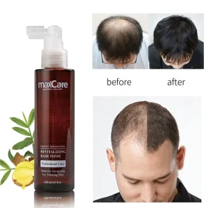 Organic Hair Growth Spray Anti Hair Loss Smooth Strong Long Hair Regrowth Conditioner Herbal Private Label