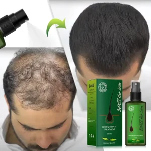 Organic Hair Regeneration Scalp Care Massage Essential Oil for Hair Growth Products Natural Hair Spray