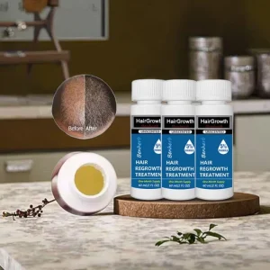 Organic Hairoil DHT Blocker for Damaged Curly Dry Hair with Biotin Formula and Herbal Nourishing
