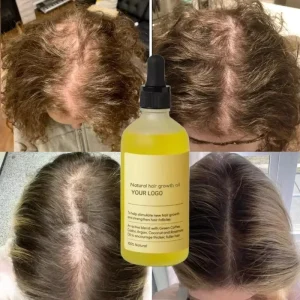 Organic Rosemary Hair Growth Oil Natural Scalp Care Hair Regrowth Treatment Massage Oil Essential Hair Care