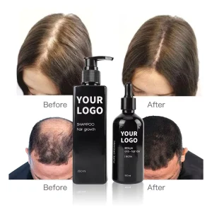 Organic Scalp Care Hair Growth Serum Private Label Regrowth Treatment with Coconut Oil Ginseng Ginger Anti Loss Hair Repair Oil