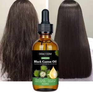 Organic Vegan Nourishing Strong Healthy Hair Treatment Scalp OEM/ODM Regrowth Oil Hair Growth Serum Black Castor Oil
