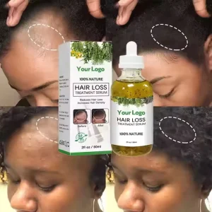 Private Label 100% Natural Hair Oil for Regrowth Organic Anti Loss Hair Treatment Fast Rosemary Oil Hair Growth Oil