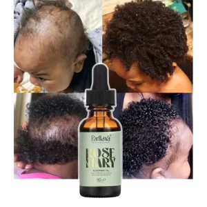 Private Label 100% Natural Herbal Organic Baby Scalp Care Loss Treatment Rosemary Hair Growth Oil Serum for Hair