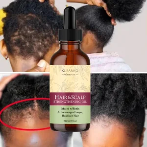 Private Label 100% Natural Organic Hair Growth Oil Serum Rosemary Mint Scalp Strengthening Moisturizing Hair Growth