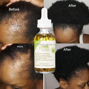 Private Label 100% Natural Rosemary Castor Oil Men Women Hair Treatment Scalp Care Serum Hair Growth Oil Elixir