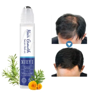 Private Label 100% Organic Vegan Nourishing Scalp Anti Hair Loss Treatments Growth Oil Hair Regrowth Serum and Roller Set