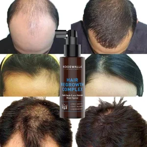 Private Label 100ML Natural Anti Hair Loss Formula Serum Hair Growth Spray with Biotin Repair Hair Follicles