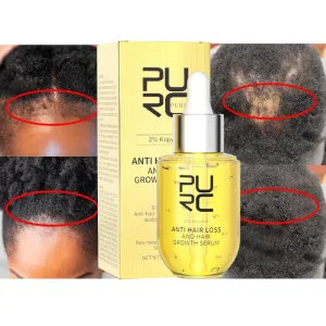 Private Label Anti-loss Hair Treatment Regrowth Serum Hair Grow Oil Natural Organic Hair Growth Oil