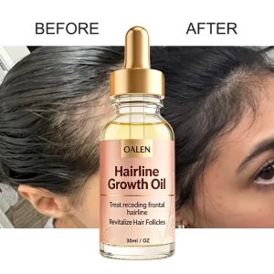 Private Label Biotin Infused Hairline Growth Oil Serum Anti Hair Loss Treatment for Thicker Hair and Rapid Beard Regrowth
