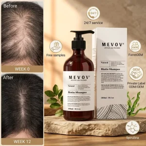 Private Label Biotin Shampoo Hair Loss Treatments Hair Growth for All Hair Types Shampoo Repousse Des Cheveux Shampoing
