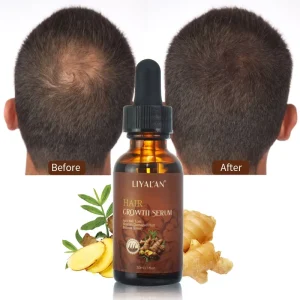 Private Label Ginger Nourish Scalp Repair Hair Loss Treatment Regrowth Hair Growth Oil Serum