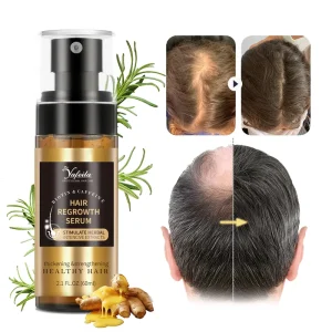 Private Label Hair Growth Tonic Spray with Rosemary Biotin Repair Thinning Hair & Receding Hairline