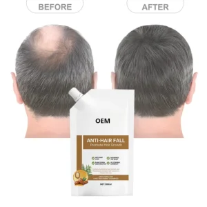 Private Label Herbal Hair Growth Oils Shampoos Scalp Regrowth Treatment Essential Tonics for Natural Hair Care