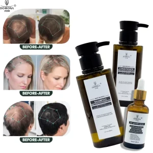 Private Label Herbal Hair Growth Oils Shampoos Scalp Regrowth Treatment Products Essential Tonics for Natural Hair Care