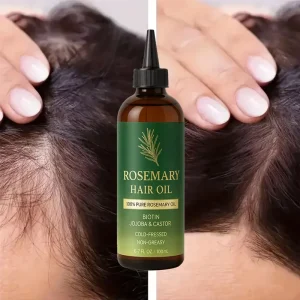 Private Label Herbal Scalp Hair Treatment Essential Serum Oils Rosemary Oil for Long Hair Growth Anti Loss Regrowth