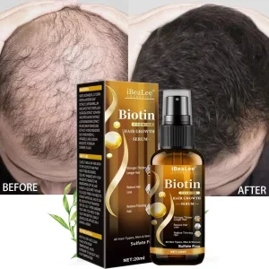 Private Label IBeaLee Anti Loss Biotin Hair Growth Serum Spray for Women and Men Beard Growth Serum
