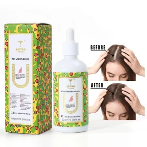 Private Label Natural Anti Hair Loss Regrowth Treatment Biotin Castor Oil Rosemary Oil Hair Growth Oil for Baldness Scalp